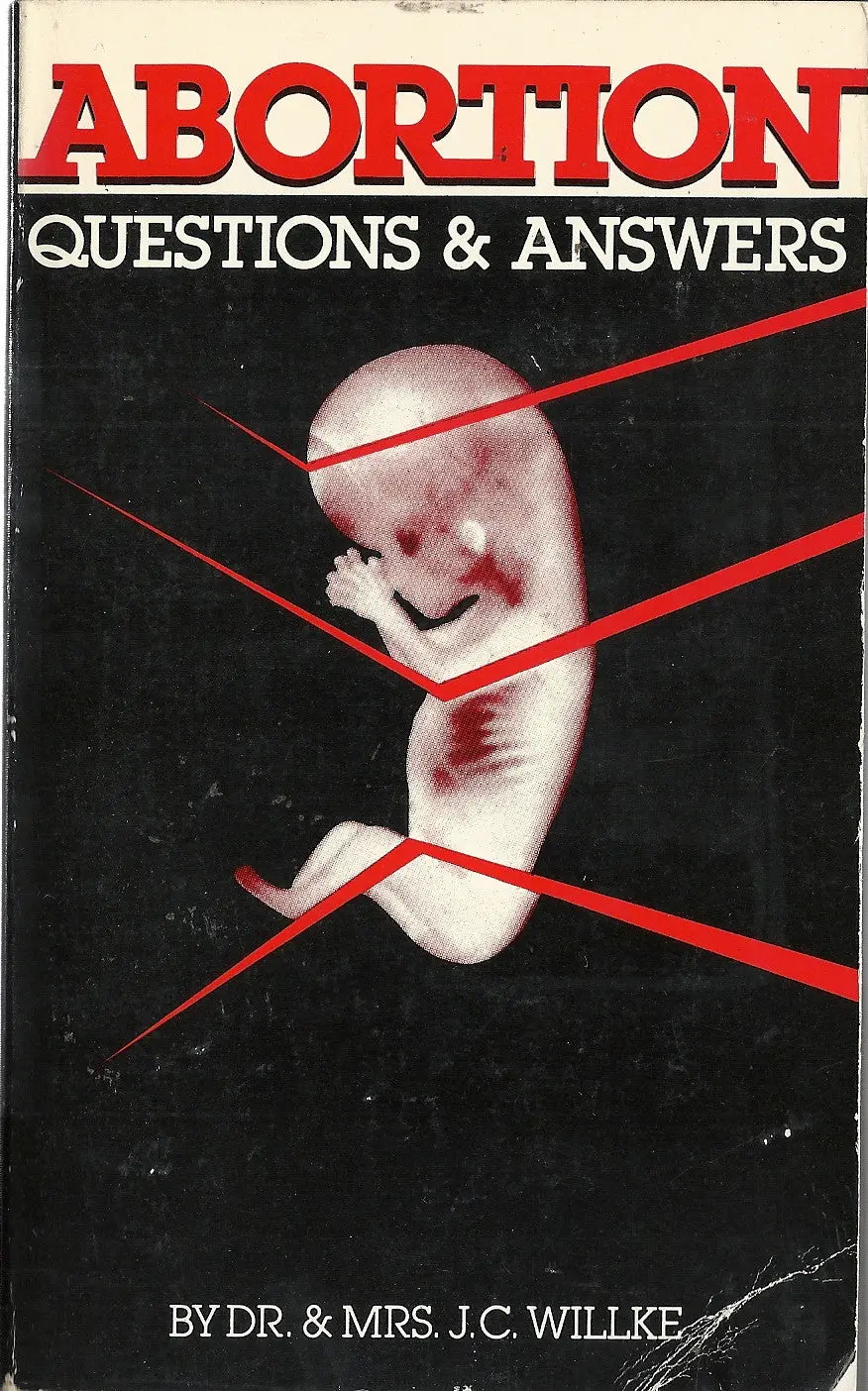 Abortion Questions & Answers 1